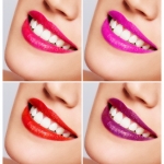 UK teeth whitening